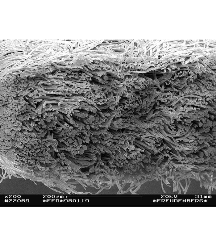Funda Colchón Antiácaros Certificada ECARF - EuroAllergy
