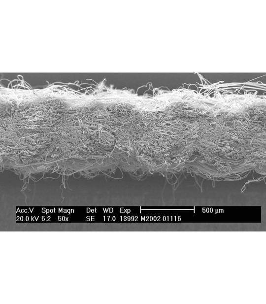 Funda Colchón Antiácaros Certificada ECARF - EuroAllergy